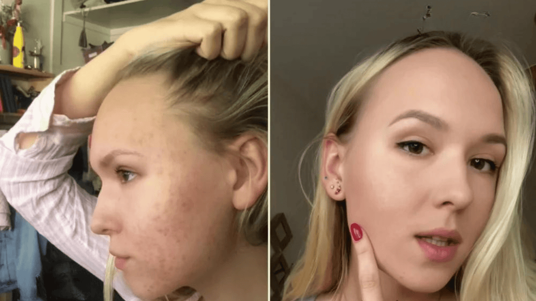 Skincare with sensitive skin in mind | OMIANA